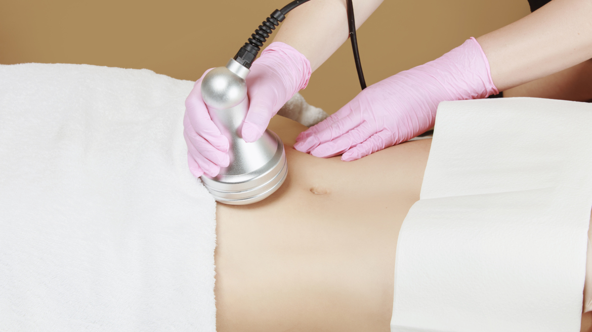 Ultrasound Cavitation