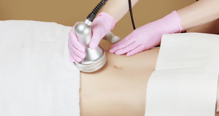 Ultrasound Cavitation